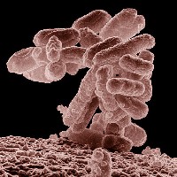 E coli bacteria magnified (ARS/Wikimedia Commons)