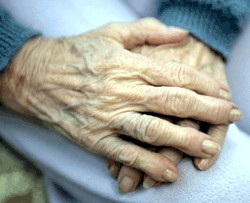Hands with arthritis (NIH)