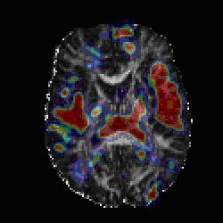Brain scan (National Institute of Mental Health)