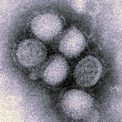 H1N1 virus (CDC)