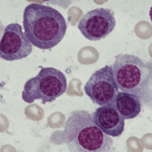 Myeloma cells (NIH)