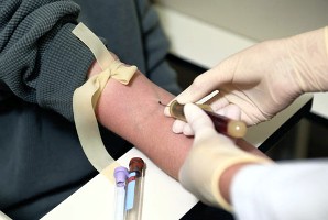 Blood test (NIH)