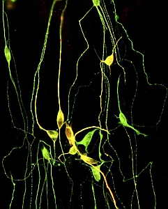 Nerve cells, in green, converted from skin cells (Julia Ladewig/University of Bonn)