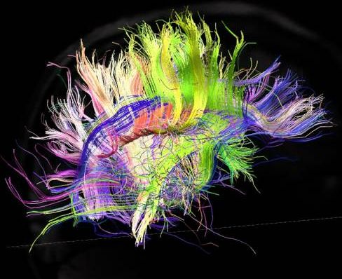 3-D brain wiring illustration