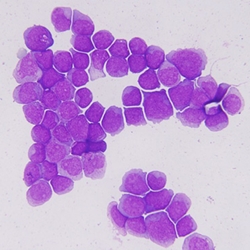 Acute myeloid leukemia cells