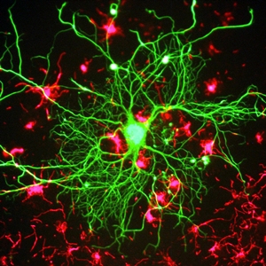 Neuron in tissue culture