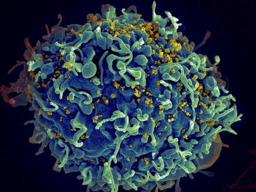 HIV particles infecting human T cell