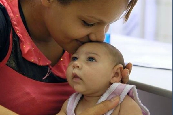Baby with microcephaly