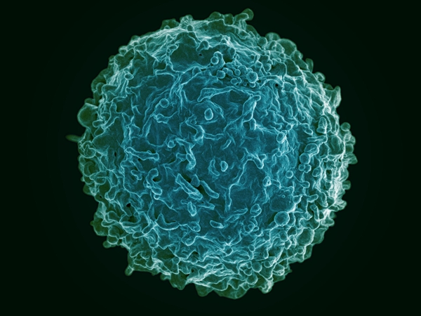 Human B-cell