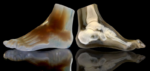 3-D print foot model and CT image