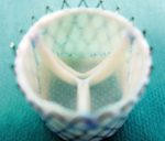 Computer-Designed Heart Valves Operate Over Long Term