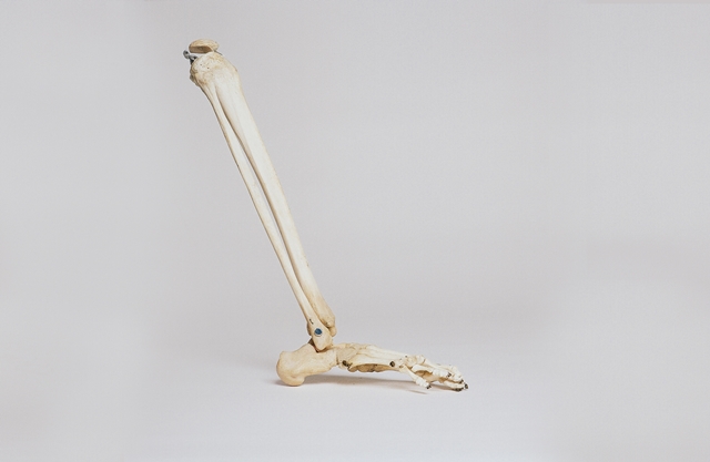 Tibia and fibula bones