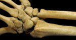 Bones in the wrist and hand