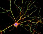 Nerve cells in brain
