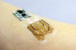 Smart Bandage Monitors, Provides Drugs to Chronic Wounds