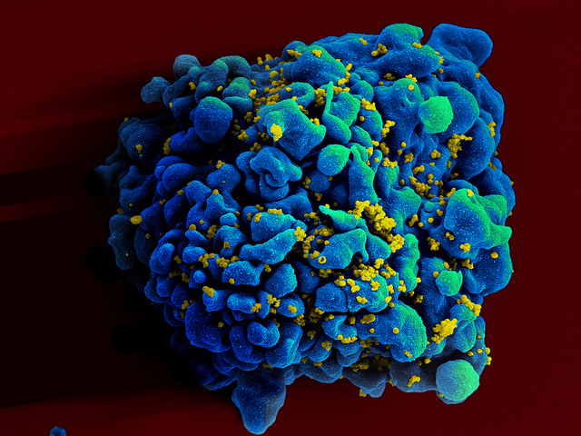 T-cell infected by HIV