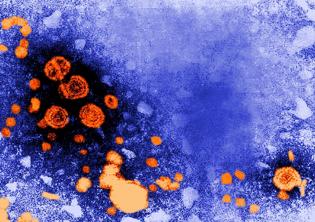 Hepatitis-B virus