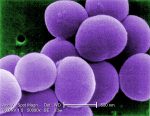 MRSA bacteria