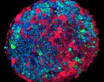 Brain Tissue Model Devised for Cancer Drug Testing