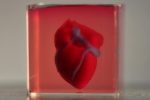 Human Heart 3-D Printed from Patient Cells