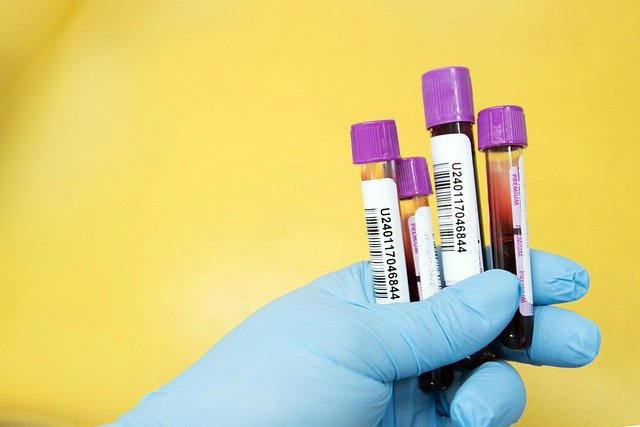 Blood sample vials