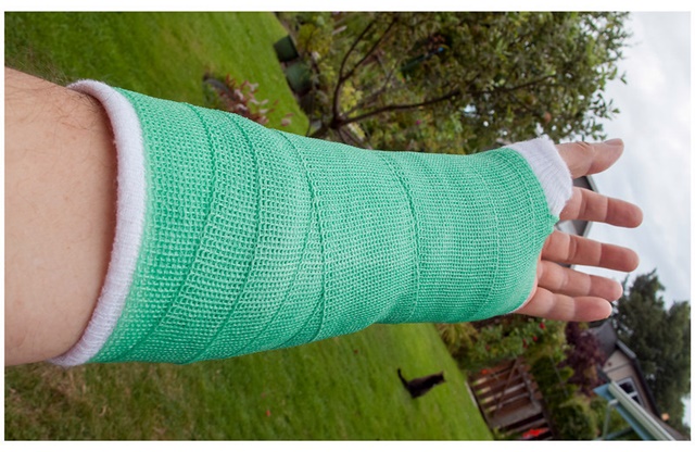 Broken wrist in cast