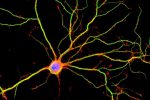 Mature neuron