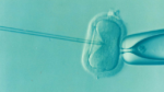 IVF microscopic image