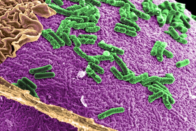 Microscopic image of human intestinal cells cultured with specific gut bacteria