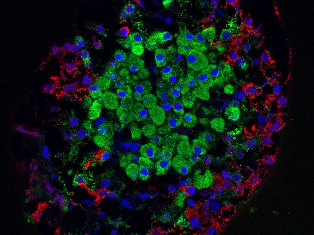 Microscopic image of islet cells from the pancreas